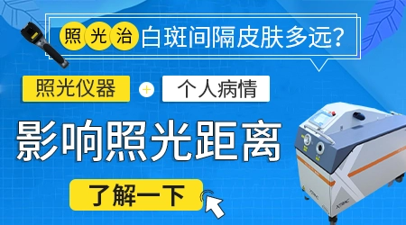 308激光和311紫外线照白癜风的区别