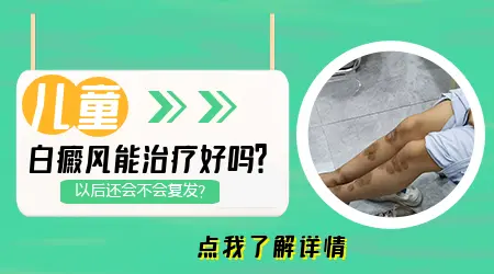 儿童白癜风早期能治好吗 有什么安全的治疗方法