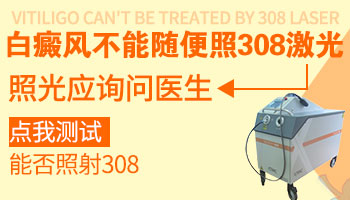 白癜风用什么机器照的效果好