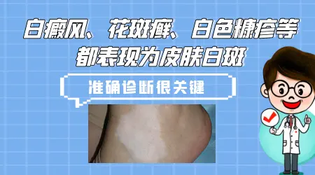 小孩嘴角有一块明显的白怎么回事