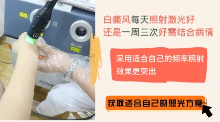 女生下面有白斑好不好治疗