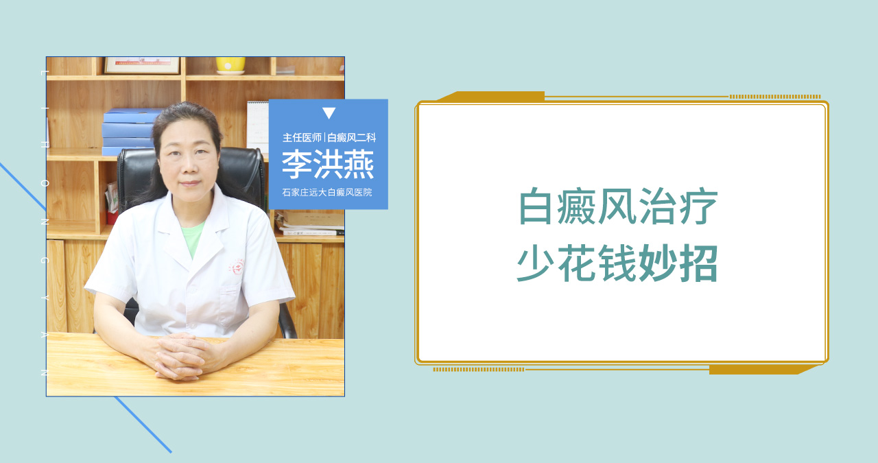 这些白癜风治疗少花钱的妙招你知道吗