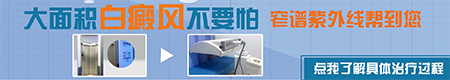 311窄谱UVB紫外线光疗仪适合什么类型白癜风