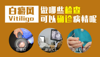 白斑在大腿根两个月了怎么治