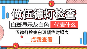 伍德灯照白斑照出来是弱荧光什么意思