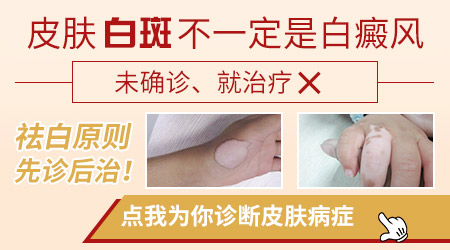 屁股上有白色斑块怎么治疗