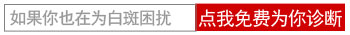 宝宝特别小得了白癜风能治疗吗