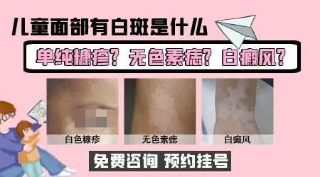 儿童白斑早期图片大全
