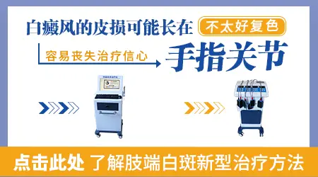 手指脚趾白斑为什么难治 肢端型应对办法