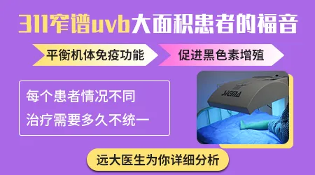 白癜风用311窄谱UVB治疗效果好吗