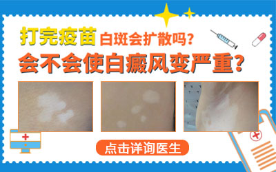 扎完第一针新冠疫苗后白癜风突然发展了怎么回事