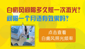 白癜风照美国308激光一星期一次管用吗