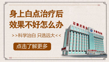 上半身好多小白点用什么方法能治好