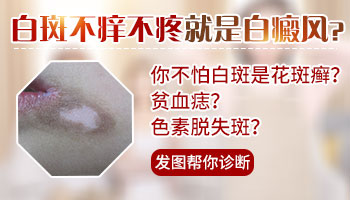 肚子长白斑如果是白癜风会不会痒