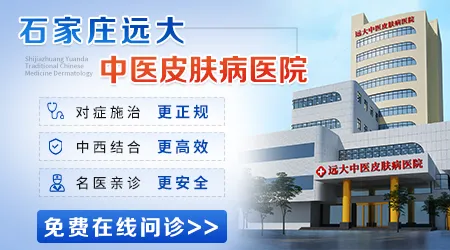 石家庄哪家医院治白癜风复色快