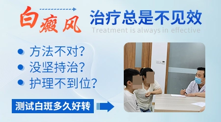 白癜风用药一直没见效是不是治不好