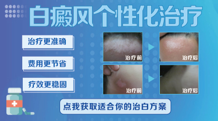 腿上有小白点半个月了怎么回事