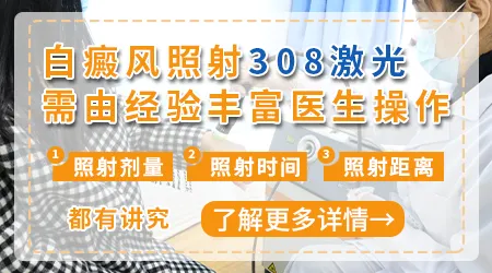 6岁孩子面部白癜风能不能照308准分子激光