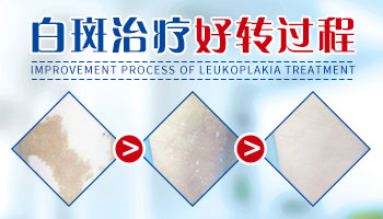 白癜风黑色素岛生长速度