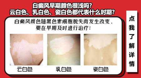 白癜风是粉色还是白色