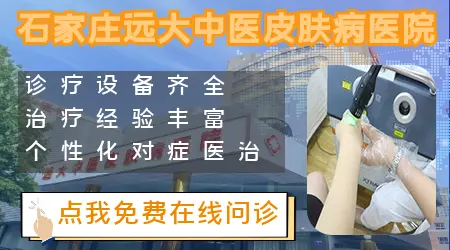 白癜风治好过的图片