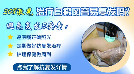 面部白癜风照308激光后会复发吗