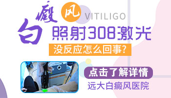 308分子激光照白癜风第一次什么反应