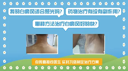 白癜风家用光疗仪和医院的有区别吗