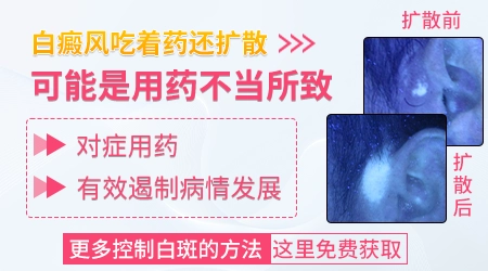 吃白癜风药还有新斑出现是什么原因