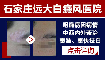 家庭版308光疗仪跟医院大型308效果一样吗