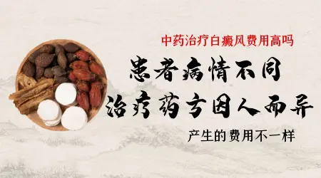 口服中药治疗白癜风怎么收费