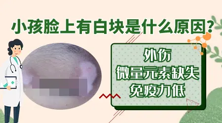 小孩面部出现白斑点是什么原因引起的