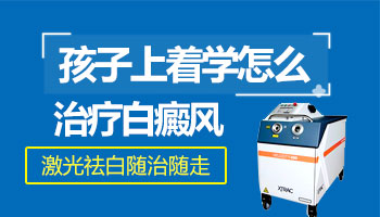 刚确诊孩子白癜风怎么治