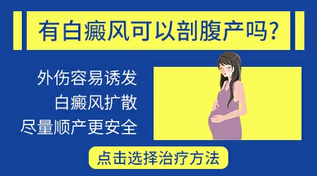 剖腹产会不会造成白癜风严重