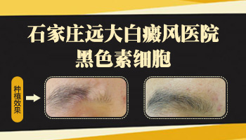 白癜风做种植手术效果怎么样