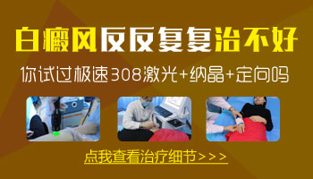 白癜风照308后又复发了