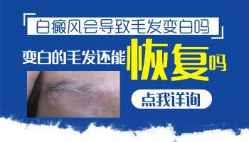 头上长白斑白发的图片