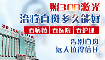 白癜风用激光治疗一般照射几次能好