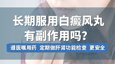 长期服用白癜风丸有副作用吗