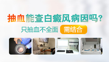 女性额头有两块白癜风怎么治疗好