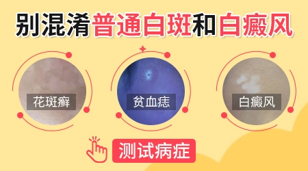 背部白斑早期图片