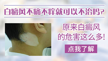 宝宝白癜风发现后不治疗会怎样