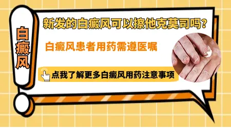 他克莫司治疗白癜风怎么样