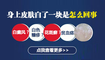胳膊和腿上都有不明显白斑