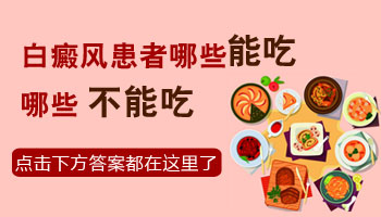 308怎么收费 面部淡白色的白癜风能治好吗