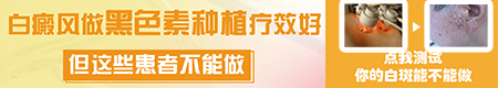 种植治疗白癜风的方法都有哪些