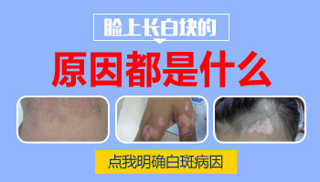 脸上多个地方出现白斑是什么 为什么长白斑