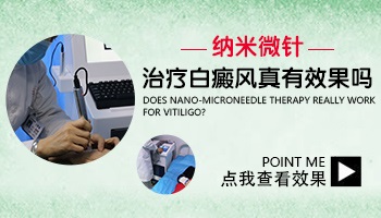 纳米微针治白癜风导入的是什么药物