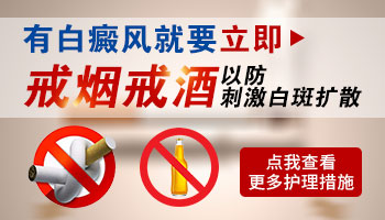 疫情期间白癜风患者居家这件事一定不要做