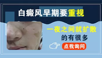 白癜风一夜之间长出来了是什么原因